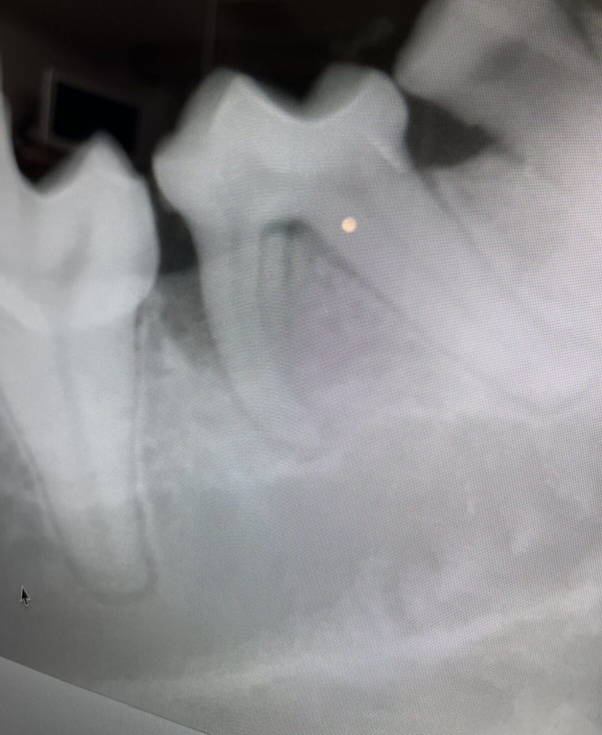 歯科レントゲン　犬の歯